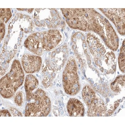 IHC-P analysis of human kidney tissue using GTX04955 MID1 antibody. Antigen retrieval : Heat mediated antigen retrieval with citrate buffer. Dilution : 1:100 IHC-P analysis of human kidney tissue using GTX04955 MID1 antibody. Antigen retrieval : Heat mediated antigen retrieval with citrate buffer. Dilution : 1:100