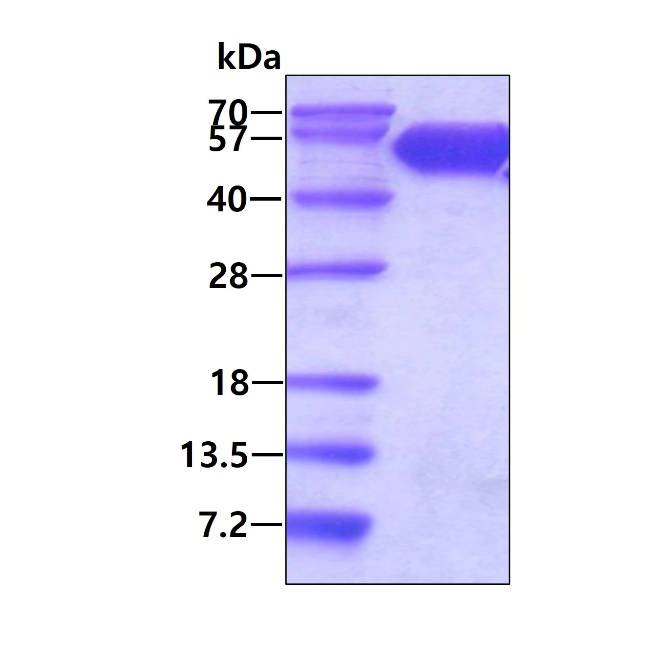 SDS-PAGE of GTX04956-pro Human CD47 (ECD) protein, Human IgG Fc tag and His tag. Loading : 3 microg