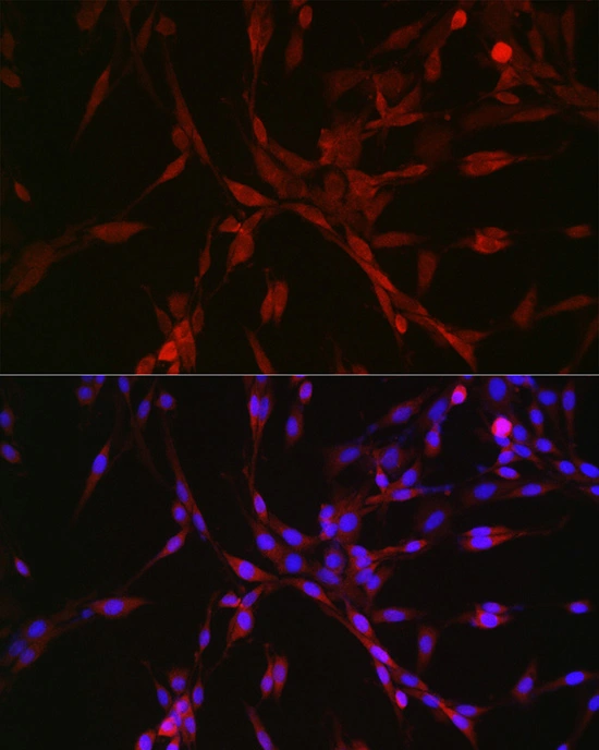 ICC/IF analysis of PC-12 cells using GTX04958 GATSL3 antibody. Orange : Primary antibody Blue : DAPI Dilution : 1:50 ICC/IF analysis of PC-12 cells using GTX04958 GATSL3 antibody. Orange : Primary antibody Blue : DAPI Dilution : 1:50