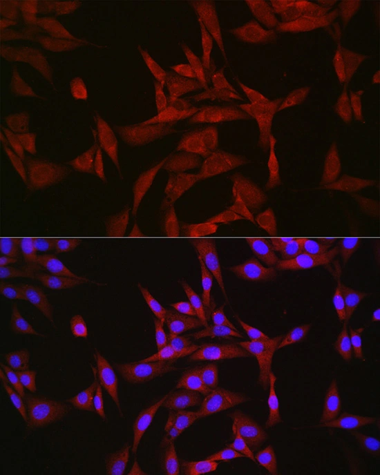 ICC/IF analysis of NIH/3T3 cells using GTX04958 GATSL3 antibody. Orange : Primary antibody Blue : DAPI Dilution : 1:50