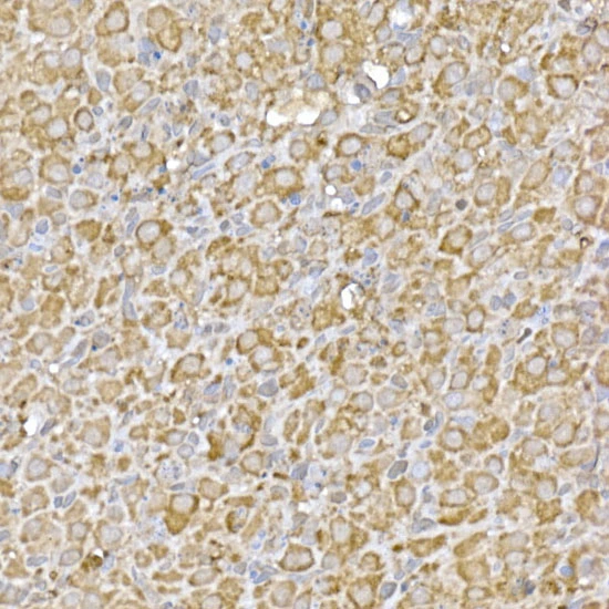 IHC-P analysis of rat ovary tissue using GTX04958 GATSL3 antibody. Antigen retrieval : High pressure antigen retrieval with 10 mM citrate buffer pH 6.0 Dilution : 1:50