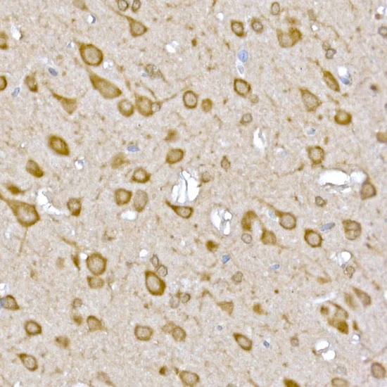 IHC-P analysis of rat brain tissue using GTX04958 GATSL3 antibody. Antigen retrieval : High pressure antigen retrieval with 10 mM citrate buffer pH 6.0 Dilution : 1:50