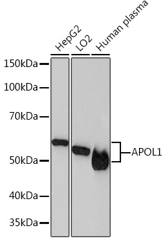 WB analysis of various samples using GTX04962 Apolipoprotein L1 antibody [ARC1124]. Loading : 25microg Dilution :1:1000