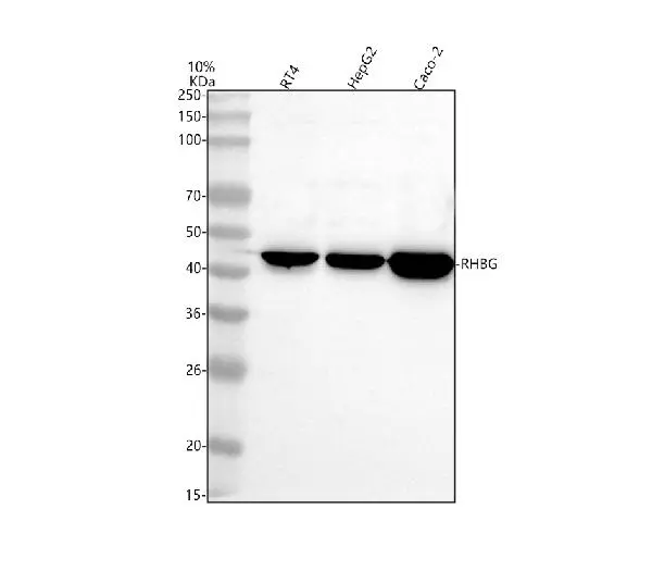 WB analysis of various samples using GTX04977 RHBG antibody. Loading : 30microg Dilution : 0.5 microg/mL