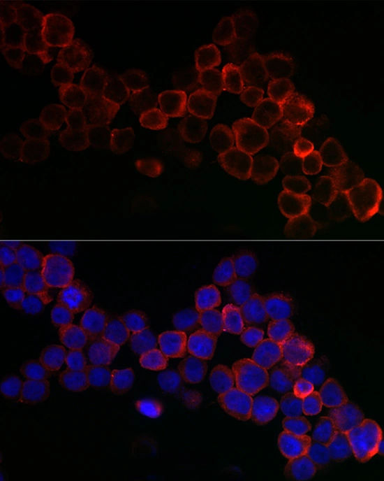 ICC/IF analysis of THP-1 cells using GTX04981 GPX1 antibody. Orange : Primary antibody Blue : DAPI Dilution : 1:200
