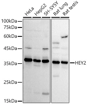 WB analysis of various samples using GTX04982 HEY2 antibody. Loading : 25microg Dilution :1:1000 WB analysis of various samples using GTX04982 HEY2 antibody. Loading : 25microg Dilution :1:1000