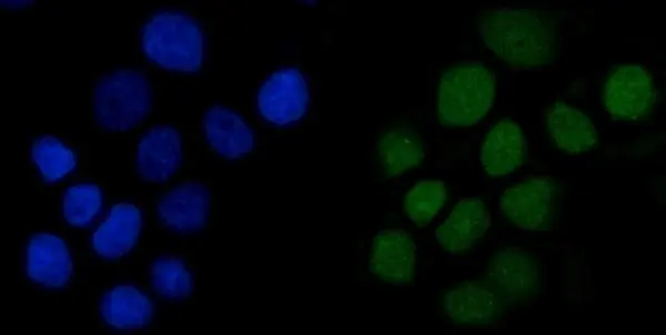 ICC/IF analysis of PFA-fixed A431 cells using GTX04984 Anillin antibody. Green : Primary antibody Blue : DAPI Antigen retrieval : Enzyme antigen retrieval buffer Dilution : 5 microg/mL