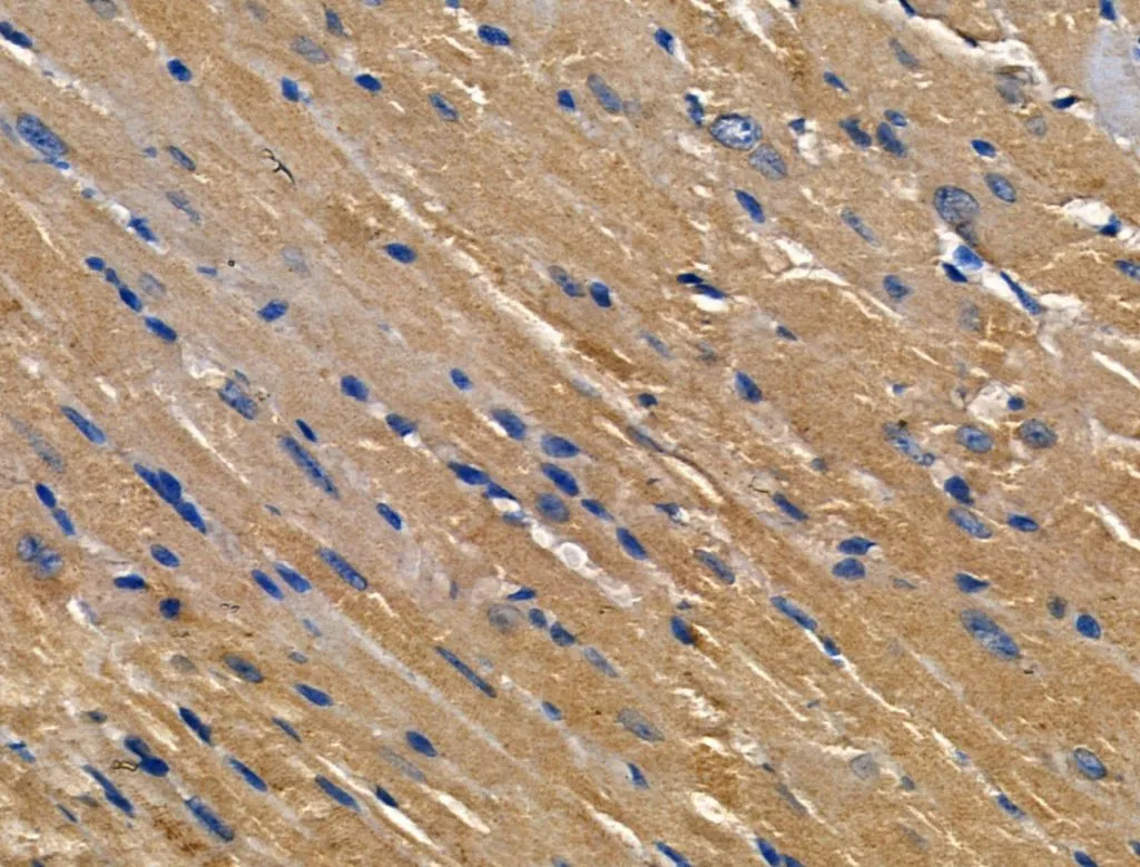 IHC-P analysis of mouse heart tissue using GTX04987 Interferon gamma antibody. Antigen retrieval : Heat mediated antigen retrieval in citrate buffer Dilution : 1:100 IHC-P analysis of mouse heart tissue using GTX04987 Interferon gamma antibody. Antigen retrieval : Heat mediated antigen retrieval in citrate buffer Dilution : 1:100