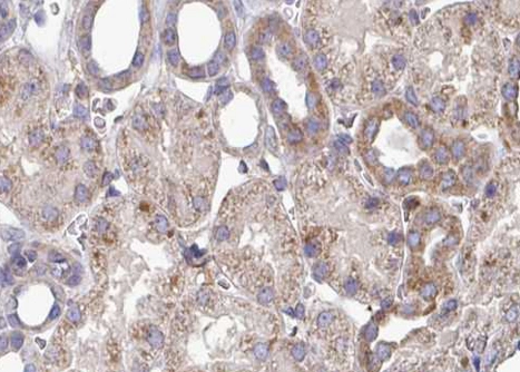 IHC-P analysis of human kidney tissue using GTX04987 Interferon gamma antibody. Antigen retrieval : Heat mediated antigen retrieval in citrate buffer Dilution : 1:100