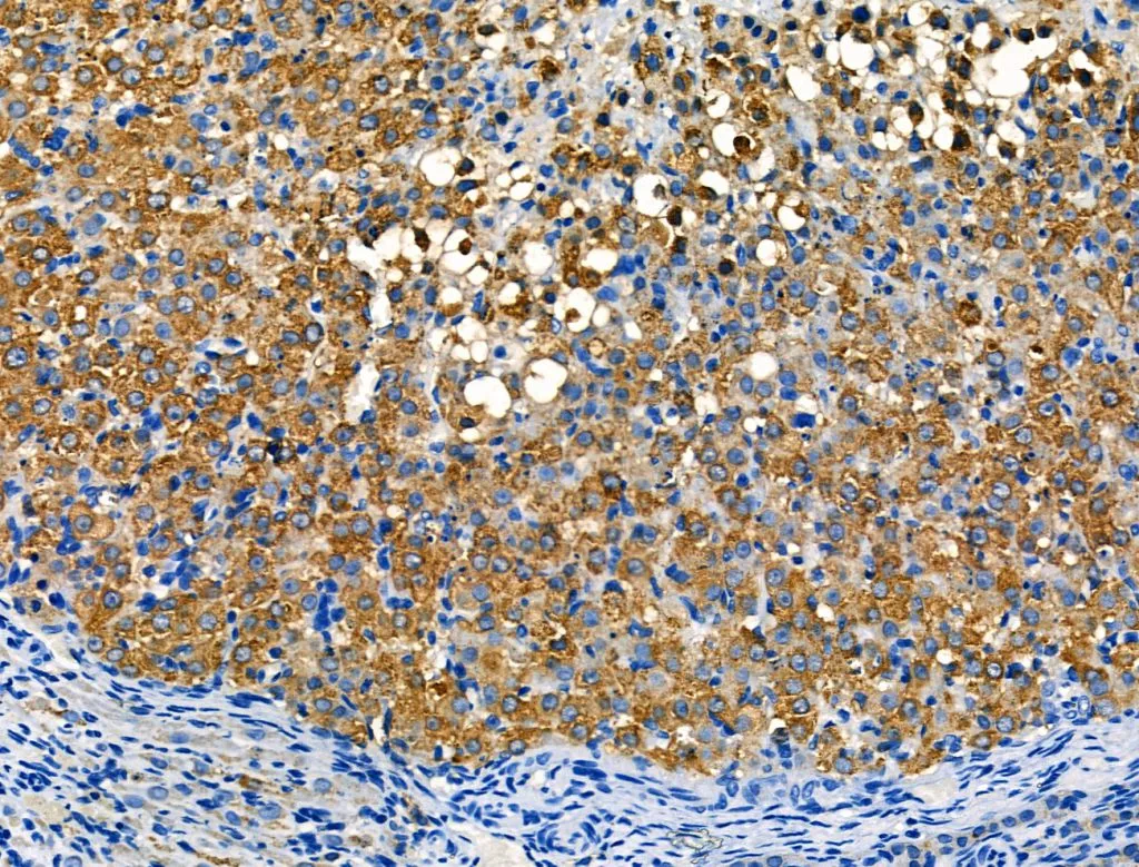 IHC-P analysis of rat ovarian tissue using GTX04987 Interferon gamma antibody. Antigen retrieval: Heat mediated antigen retrieval in citrate buffer Dilution : 1:100