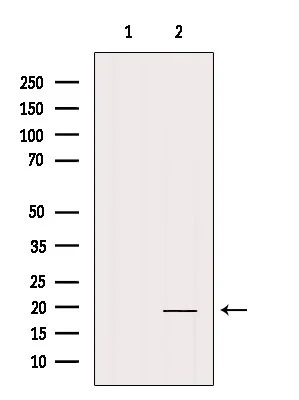 WB analysis of mouse liver tissue lysate using GTX04987 Interferon gamma antibody. The lane on the left was treated with blocking peptide.