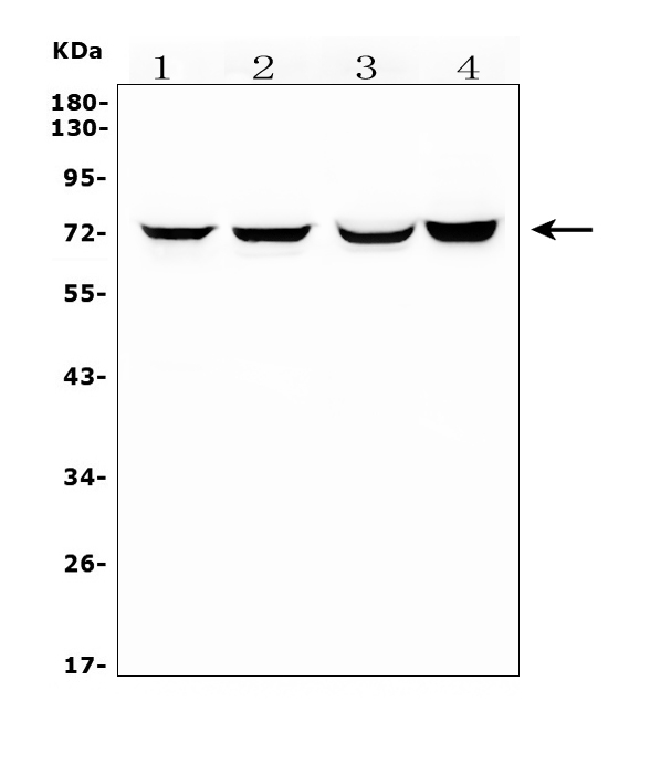 WB analysis of various samples using GTX04988 HIF3 alpha antibody. Lane 1 : Rat lung tissue lysate Lane 2 : Rat skeletal muscle tissue lysate Lane 3 : Mouse lung tissue lysate Lane 4 : NIH3T3 whole cell lysate Loading : 50microg Dilution : 0.5 microg/mL