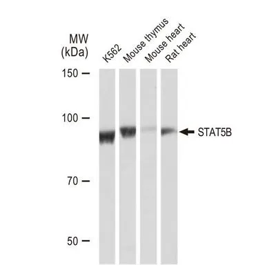WB analysis of various samples using GTX08967 STAT5B antibody [GT1160].<br>Dilution : 1:1000<br>Loading : 25?g