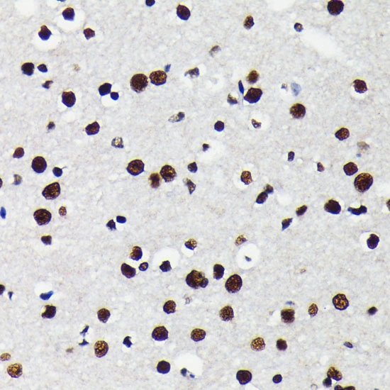 IHC-P analysis of mouse brain tissue section using GTX08968 KAP1 antibody [GT1161]. Dlution : 1:100