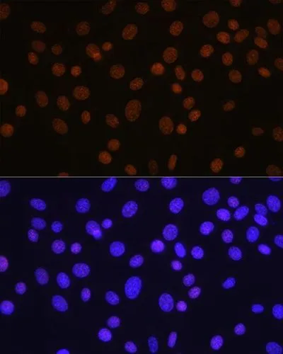 IHC-P analysis of mouse brain tissue section using GTX08970 HDAC1 antibody [GT1163]. Dlution : 1:100