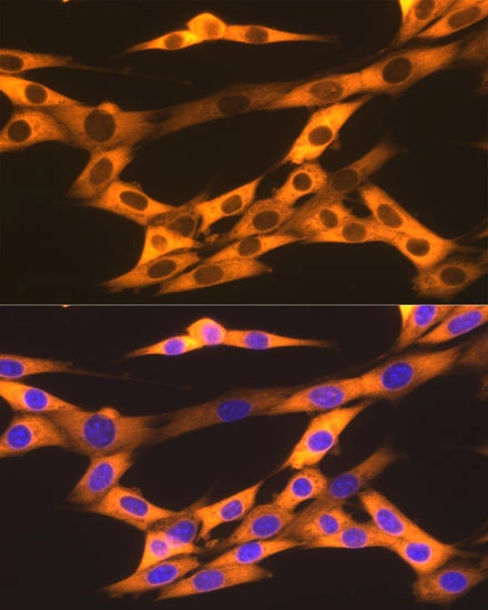 ICC/IF analysis of NIH3T3 cells using GTX09012 Hsp90 beta antibody [GT1164]. Orange: Primary antibody Blue: DAPI