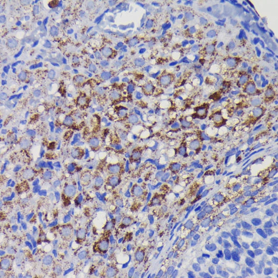 IHC-P analysis of hmuan esophageal tissue section using GTX09013 SOD2 antibody [GT1165]. Dlution : 1:100