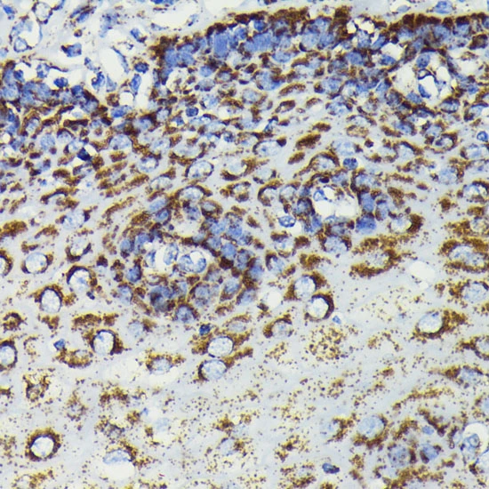 ICC/IF analysis of NIH3T3 cells using GTX09013 SOD2 antibody [GT1165]. Orange: Primary antibody Blue: DAPI