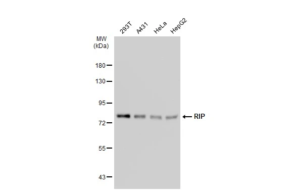 Various whole cell extracts (30 microg) were separated by 7.5% SDS-PAGE, and the membrane was blotted with RIP antibody [GT1168] (GTX09128) diluted at 1:500. The HRP-conjugated anti-rabbit IgG antibody (GTX213110-01) was used to detect the primary antibody.