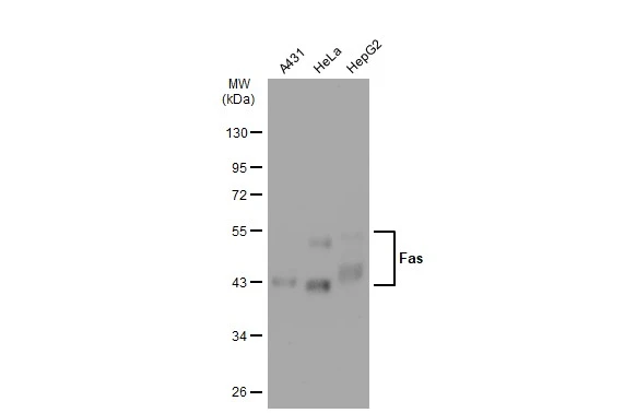 Various whole cell extracts (30 microg) were separated by 10% SDS-PAGE, and the membrane was blotted with Fas antibody [GT1169] (GTX09129) diluted at 1:500. The HRP-conjugated anti-rabbit IgG antibody (GTX213110-01) was used to detect the primary antibody.
