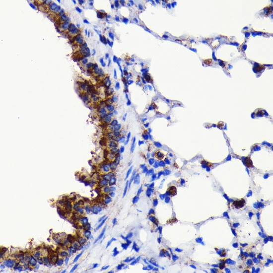 IHC-P analysis of mouse lung tissue section using GTX09507 ATG3 antibody [GT1174]. Dlution : 1:100