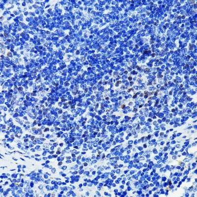 IHC-P analysis of mouse spleen tissue section using GTX09509 PARP antibody [GT1176]. Dlution : 1:100