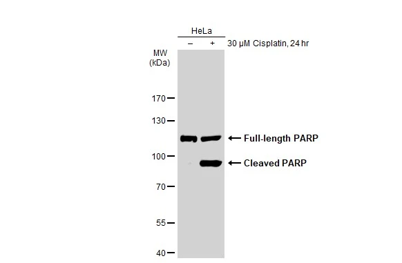 Untreated (-) and treated (+) HeLa whole cell extracts (30 microg) were separated by 7.5% SDS-PAGE, and the membrane was blotted with PARP antibody [GT1176] (GTX09509) diluted at 1:500. The HRP-conjugated anti-rabbit IgG antibody (GTX213110-01) was used to detect the primary antibody.