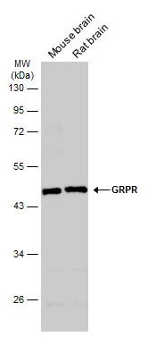 Various tissue extracts were separated by 10% SDS-PAGE,and the membrane was blotted with GRPR antibody [C1C2],Internal (GTX100015) diluted at 1:1000. The HRP-conjugated anti-rabbit IgG antibody (GTX213110-01) was used to detect the primary antibody.