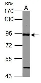 ABR antibody [C3], C-term detects ABR protein by Western blot analysis. A. 50 μg mouse brain lysate/extract 7.5 % SDS-PAGE ABR antibody [C3], C-term (GTX100031) dilution: 1:1000