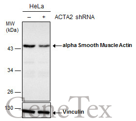 alpha smooth muscle Actin antibody detects alpha smooth muscle Actin protein by western blot analysis.