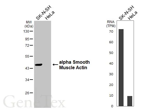 Anti-alpha Smooth Muscle Actin antibody (GTX100034) | GeneTex