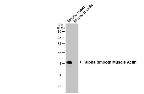 Anti-alpha Smooth Muscle Actin antibody (GTX100034) | GeneTex