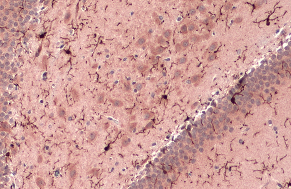 Iba1 antibody detects Iba1 protein at cell membrane and cytoplasm by immunohistochemical analysis. Sample: Paraffin-embedded rat brain. Iba1 stained by Iba1 antibody (GTX100042) diluted at 1:500. Antigen Retrieval: Citrate buffer, pH 6.0, 15 min