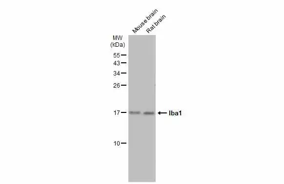 Various tissue extracts (50 μg) were separated by 15% SDS-PAGE, and the membrane was blotted with Iba1 antibody (GTX100042) diluted at 1:1000. The HRP-conjugated anti-rabbit IgG antibody (GTX213110-01) was used to detect the primary antibody.