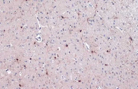 Iba1 antibody detects Iba1 protein at cell membrane and cytoplasm by immunohistochemical analysis. Sample: Paraffin-embedded mouse cerebellum. Iba1 stained by Iba1 antibody (GTX100042) diluted at 1:500. Antigen Retrieval: Citrate buffer, pH 6.0, 15 min