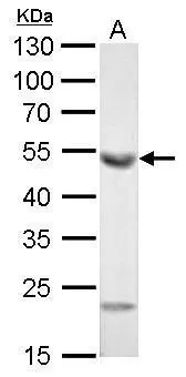 ALDH1A1 antibody [C3], C-term detects ALDH1A1 protein by Western blot analysis. A. 50 μg mouse liver lysate/extract 10 % SDS-PAGE ALDH1A1 antibody [C3], C-term (GTX100043) dilution: 1:10000
