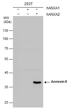 Annexin II antibody detects Annexin II protein by western blot analysis. Non-transfected (-) and human Annexin I or Annexin II-transfected (+) whole cell extracts (30 μg) were separated by 10% SDS-PAGE, and the membrane was blotted with Annexin II antibody (GTX100046) diluted at 1:1000. The HRP-conjugated anti-rabbit IgG antibody (GTX213110-01) was used to detect the primary antibody. Annexin II antibody detects Annexin II protein by western blot analysis. Non-transfected (-) and human Annexin I or Annexin II-transfected (+) whole cell extracts (30 μg) were separated by 10% SDS-PAGE, and the membrane was blotted with Annexin II antibody (GTX100046) diluted at 1:1000. The HRP-conjugated anti-rabbit IgG antibody (GTX213110-01) was used to detect the primary antibody.