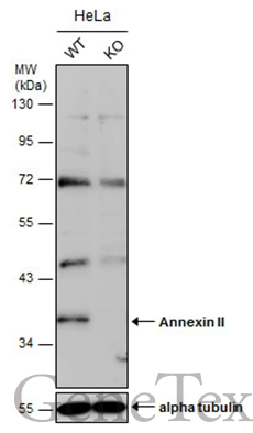Wild-type (WT) and Annexin II knockout (KO) HeLa cell extracts (30 μg) were separated by 10% SDS-PAGE, and the membrane was blotted with Annexin II antibody [N1], N-term (GTX100046) diluted at 1:1000. The HRP-conjugated anti-rabbit IgG antibody (GTX213110-01) was used to detect the primary antibody.