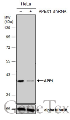 Non-transfected (–) and transfected (+) HeLa whole cell extracts (30 μg) were separated by 10% SDS-PAGE, and the membrane was blotted with APE1 antibody [N1], N-term (GTX100050) diluted at 1:2000.