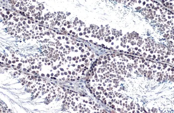 Androgen Receptor antibody [N1], N-term detects Androgen Receptor protein at cytoplasm and nucleus by immunohistochemical analysis. Sample: Paraffin-embedded mouse testis. Androgen Receptor stained by Androgen Receptor antibody [N1], N-term (GTX100056) diluted at 1:500. Antigen Retrieval: Citrate buffer, pH 6.0, 15 min