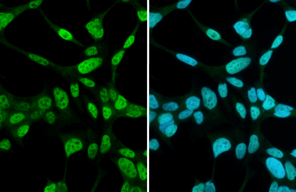 Androgen Receptor antibody [N1], N-term detects Androgen Receptor protein at nucleus by immunofluorescent analysis. Sample: LNCap cells were fixed in 4% paraformaldehyde at RT for 15 min. Green: Androgen Receptor stained by Androgen Receptor antibody [N1], N-term (GTX100056) diluted at 1:2000.