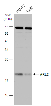Various whole cell extracts (30 μg) were separated by 12% SDS-PAGE, and the membrane was blotted with ARL2 antibody (GTX100060) diluted at 1:500. The HRP-conjugated anti-rabbit IgG antibody (GTX213110-01) was used to detect the primary antibody.