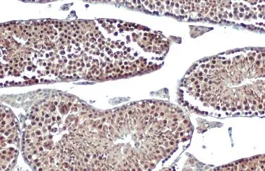DNA ligase IV antibody [N2C2], Internal detects DNA ligase IV protein at nucleus by immunohistochemical analysis. Sample: Paraffin-embedded mouse testis. DNA ligase IV stained by DNA ligase IV antibody [N2C2], Internal (GTX100100) diluted at 1:500. Antigen Retrieval: Citrate buffer, pH 6.0, 15 min