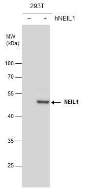 NEIL1 antibody [N1C1] detects NEIL1 protein by western blot analysis. Non-transfected (-) and NEIL1-transfected (+) 293T whole cell extracts (30 μg) were separated by 10% SDS-PAGE, and the membrane was blotted with NEIL1 antibody [N1C1] (GTX100102) diluted at 1:500.