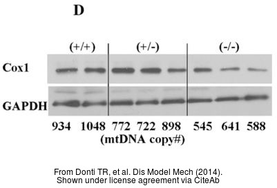 Immunoprecipitation of GAPDH protein from 293T whole cell extracts using 5 ug of GAPDH antibody (GTX100118). Western blot analysis was performed using GAPDH antibody (GTX100118). EasyBlot anti-Rabbit IgG (GTX221666-01) was used as a secondary reagent.