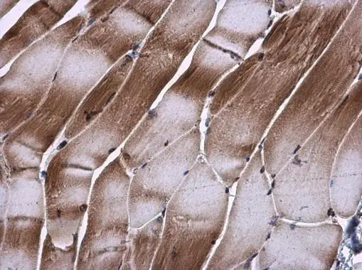 TIP30 antibody detects TIP30 protein at cytoplasm in mouse muscle by immunohistochemical analysis. Sample: Paraffin-embedded mouse muscle. TIP30 antibody (GTX100119) diluted at 1:500. 
 Antigen Retrieval: Citrate buffer, pH 6.0, 15 min