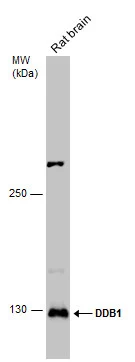 Rat tissue extract (50 μg) was separated by 5% SDS-PAGE, and the membrane was blotted with DDB1 antibody (GTX100130) diluted at 1:1000. The HRP-conjugated anti-rabbit IgG antibody (GTX213110-01) was used to detect the primary antibody. Rat tissue extract (50 μg) was separated by 5% SDS-PAGE, and the membrane was blotted with DDB1 antibody (GTX100130) diluted at 1:1000. The HRP-conjugated anti-rabbit IgG antibody (GTX213110-01) was used to detect the primary antibody.
