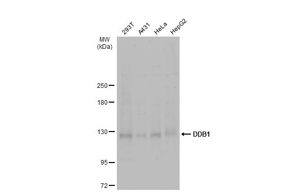 Sample (50 ug of whole cell lysate) A: Mouse brain 5% SDS PAGE GTX100130 diluted at 1:5000 The HRP-conjugated anti-rabbit IgG antibody (GTX213110-01) was used to detect the primary antibody.