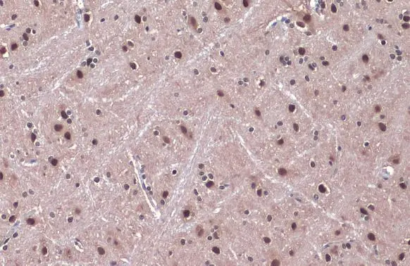 DDB1 antibody detects DDB1 protein at nucleus by immunohistochemical analysis. Sample: Paraffin-embedded rat brain. DDB1 stained by DDB1 antibody (GTX100130) diluted at 1:500. Antigen Retrieval: Citrate buffer, pH 6.0, 15 min