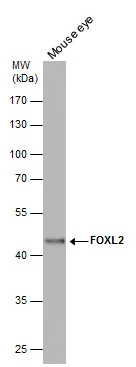 FOXL2 antibody [C3], C-term detects FOXL2 protein by western blot analysis. Mouse tissue extracts (50 μg) was separated by 10% SDS-PAGE, and the membrane was blotted with FOXL2 antibody [C3], C-term (GTX100200) diluted at 1:500.